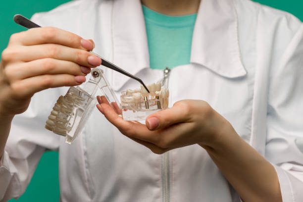 Mini Dental Implants – Giving Hope to Millions